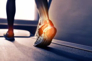 Sports Injury Doctor In Delhi