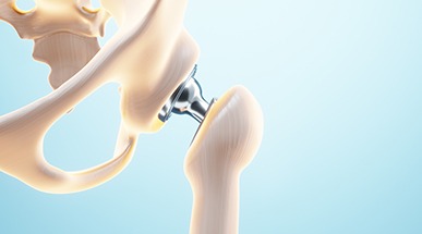 What is uncemented & cemented hip replacement?