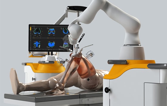 Robotic knee replacement surgery